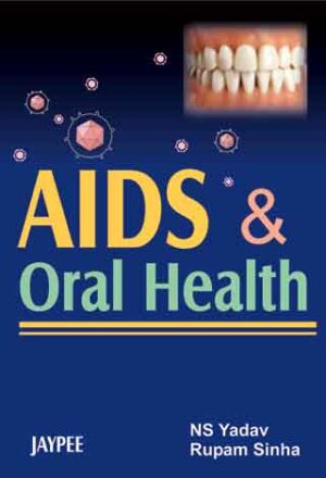 AIDS and Oral Health by NS Yadav,Rupam Sinha