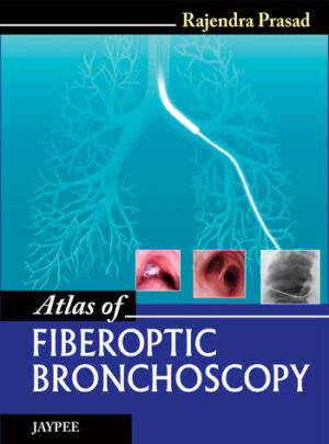 Atlas of Fiberoptic Bronchoscopy by Rajendra Prasad