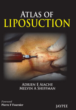 Atlas of Liposuction by Adrien E Aiache,Melvin A Shiffman