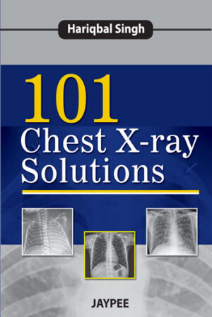 101 Chest X-ray Solutions by Hariqbal Singh