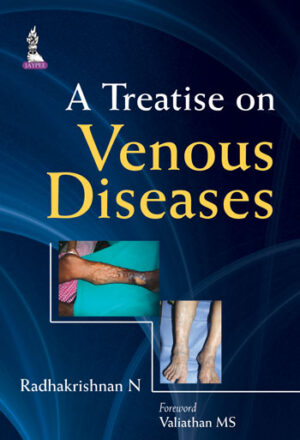 A Treatise on Venous Diseases by Radhakrishnan N