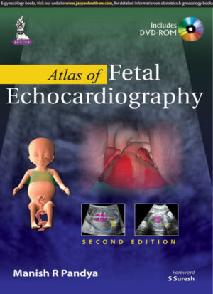 Atlas of Fetal Echocardiography (Includes DVD-ROM) by Manish R Pandya