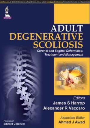 Adult Degenerative Scoliosis—Coronal and Sagittal Deformities: Treatment and Management by James S Harrop,Alexander R Vaccaro,Ahmed J Awad