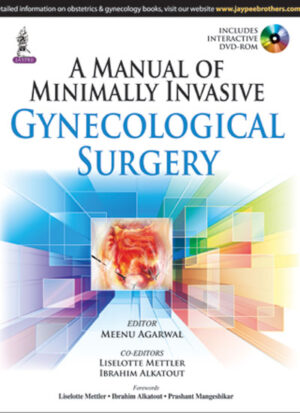 A Manual of Minimally Invasive Gynecological Surgery by Meenu Agarwal,Liselotte Mettler,Ibrahim Alkatout