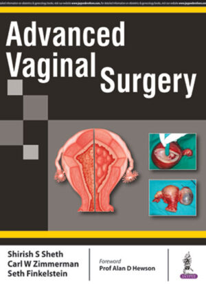 Advanced Vaginal Surgery by Shirish S Sheth,Carl W Zimmerman,Seth Finkelstein