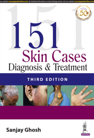 151 Skin Cases: Diagnosis & Treatment by Sanjay Ghosh