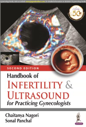 Handbook of Infertility & Ultrasound for Practicing Gynecologists by Chaitanya Nagori