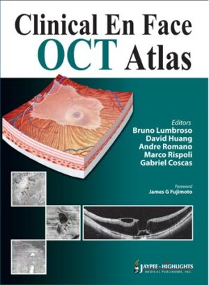 Clinical En Face OCT Atlas by Bruno Lumbroso