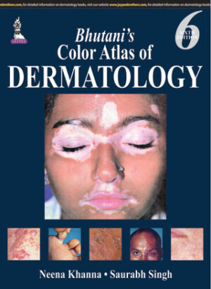 Bhutani’s Color Atlas of Dermatology by Neena Khanna