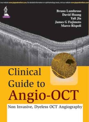 Clinical Guide to Angio-OCT (Non Invasive, Dyeless OCT Angiography) by Bruno Lumbroso