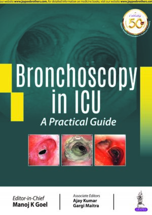 Bronchoscopy in ICU: A Practical Guide by Manoj K Goel