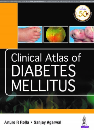 Clinical Atlas of Diabetes Mellitus by Arturo R Rolla