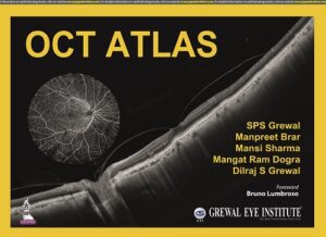 OCT Atlas by SPS Grewal