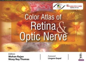 Color Atlas of Retina & Optic Nerve by Mohan Rajan