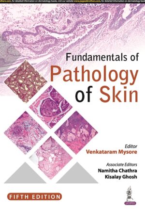 Fundamentals of Pathology of Skin by Venkataram Mysore