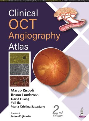 Clinical OCT Angiography Atlas by Marco Rispoli