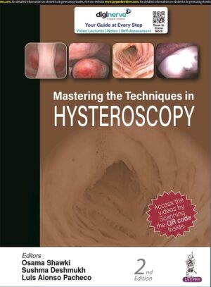 Mastering the Techniques in Hysteroscopy by Osama Shawki