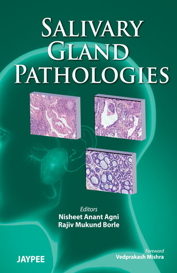 Salivary Gland Pathologies by Nisheet Anant Agni - Drcart