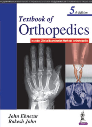 Textbook of Orthopedics (Includes Clinical Examination Methods in Orthopedics) by Rakesh John