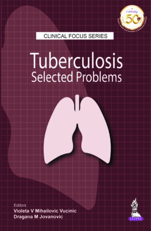 Clinical Focus Series Tuberculosis Selected Problems by Violeta V Mihailovic Vucinic