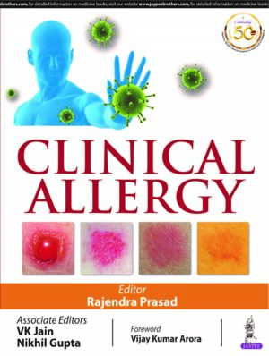 Clinical Allergy by Rajendra Prasad