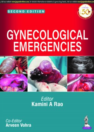 Gynecological Emergencies by Kamini A Rao