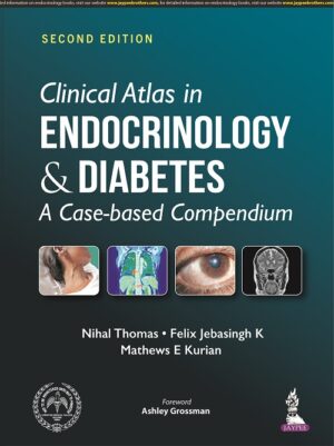 Clinical Atlas in Endocrinology & Diabetes: A Case-based Compendium by Nihal Thomas