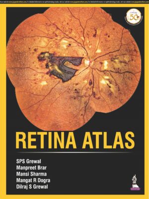 Retina Atlas by SPS Grewal