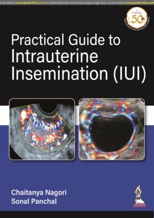 Practical Guide to Intrauterine Insemination (IUI) by Chaitanya Nagori