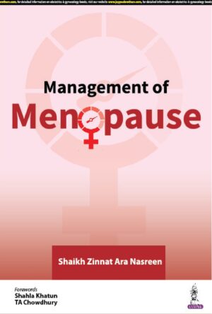 Management of Menopause by Shaikh Zinnat Ara Nasreen