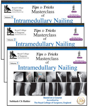 Tips & Tricks Masterclass of Intramedullary Nailing (3 Volumes): Based on a Course Accredited by The Royal College of Surgeon, England by Subhash Ch Halder