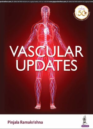 Vascular Updates by Pinjala Ramakrishna