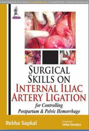 Surgical Skills on Internal Iliac Artery Ligation for Controlling Postpartum & Pelvic Hemorrhage by Rekha Sapkal