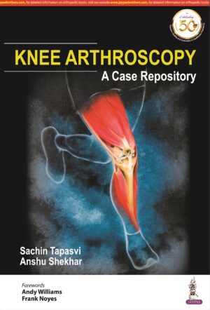 Knee Arthroscopy: A Case Repository by  Sachin Tapasvi