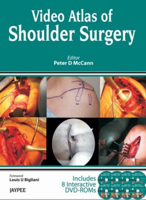 Video Atlas of Shoulder Surgery by Peter D McCann