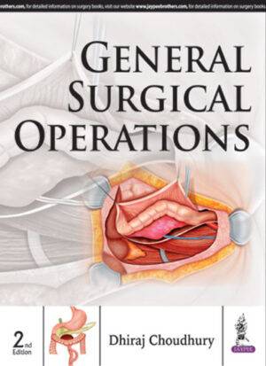 General Surgical Operations by Dhiraj Choudhury