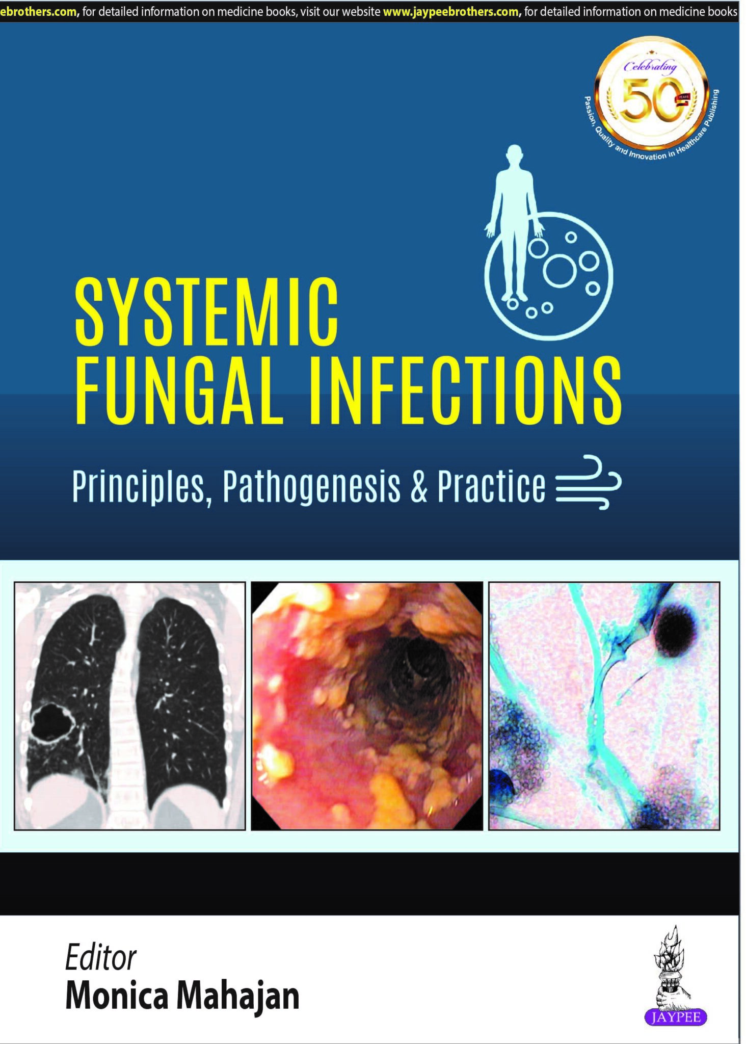 Systemic Fungal Infections: Principles, Pathogenesis & Practice by ...