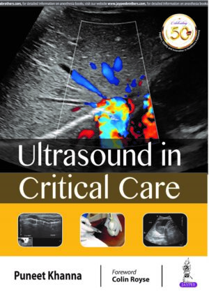 Ultrasound in Critical Care by Puneet Khanna