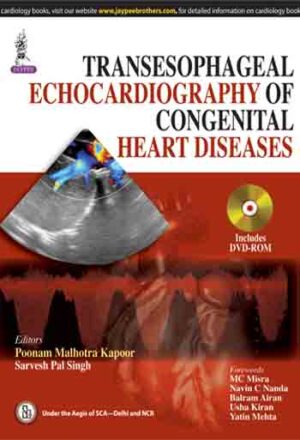 Transesophageal Echocardiography of Congenital Heart Diseases by Poonam Malhotra Kapoor