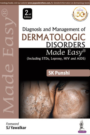 Diagnosis and Management of Dermatologic Disorders Made Easy (including STDs, Leprosy, HIV and AIDS) by SK Punshi