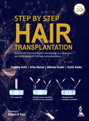 Step by Step Hair Transplantation by Pradeep Sethi