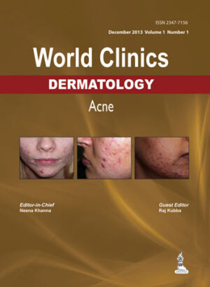 World Clinics: Dermatology - Acne(December 2013 Volume 1 Number 1) by Neena Khanna