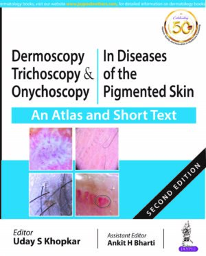 Dermoscopy, Trichoscopy & Onychoscopy in Diseases of the Pigmented Skin (An Atlas and Short Text) by Uday S Khopkar,Ankit H Bharti