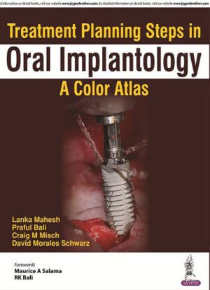 Treatment Planning Steps in Oral Implantology: A Color Atlas by Lanka Mahesh