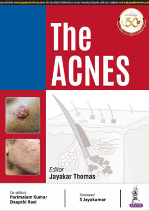 The Acnes by Jayakar Thomas