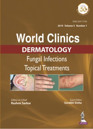 World Clinics Dermatology Fungal Infections Topical Treatments by Rashmi Sarkar