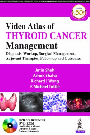 Video Atlas of Thyroid Cancer Management: Diagnosis, Workup, Surgical Management, Adjuvant Therapies, Follow-up and Outcomes by Jatin Shah