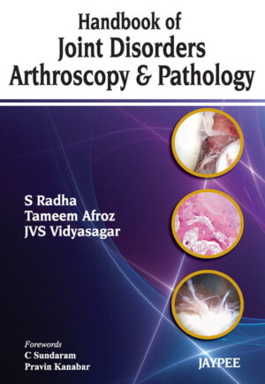 Handbook of Joint Disorders: Arthroscopy and Pathology by  S Radha