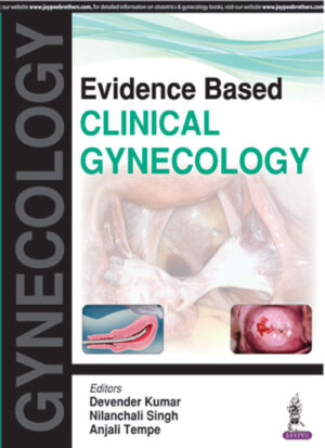 Evidence Based Clinical Gynecology by Devender Kumar