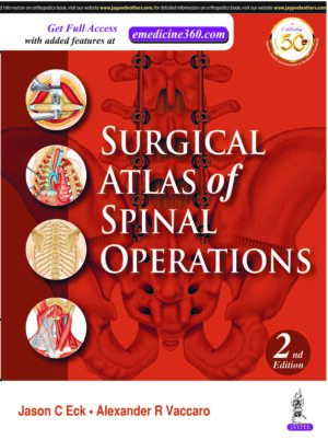 Surgical Atlas of Spinal Operations by Editors: Jason C Eck